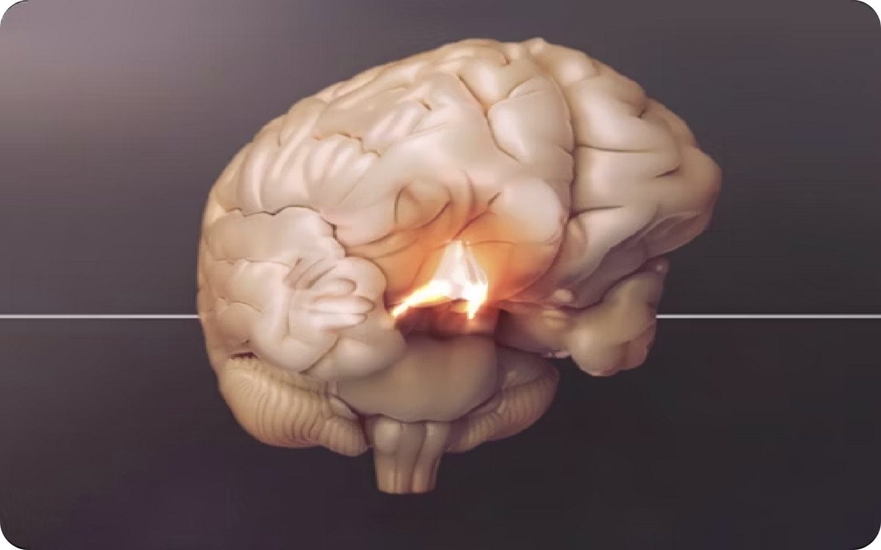 Brain with a cross section of the hypothalamus highlighted.