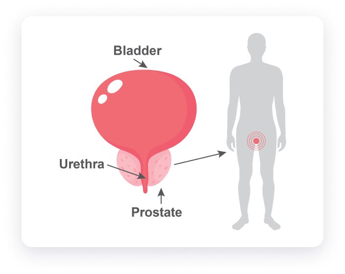 Prostate