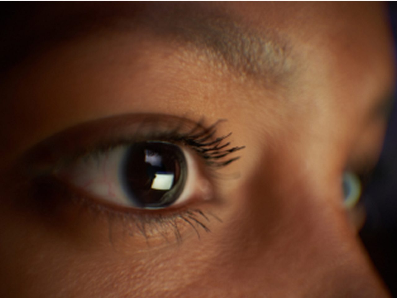 Eye diseases