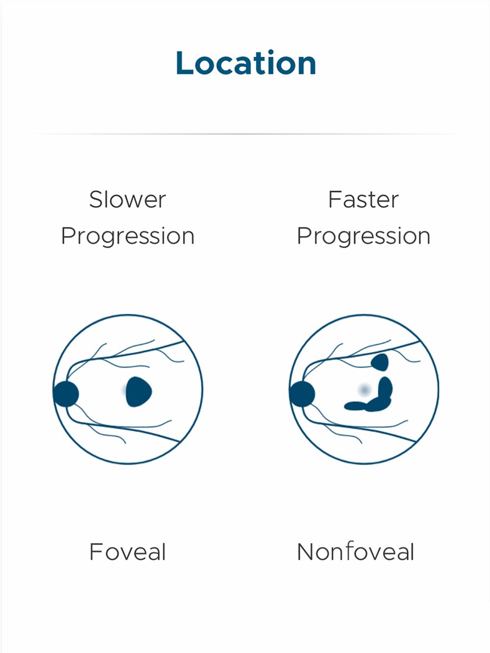 Monitoring for Progression Is Critical