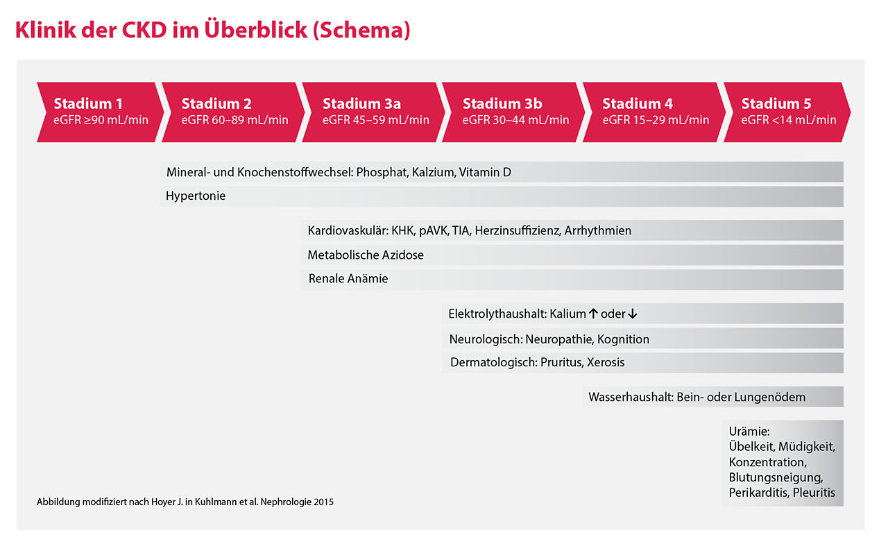 Diagramm mit den Stadien der chronischen Nierenerkrankung (CKD) nach eGFR, mit den zugehörigen Symptomen und Komplikationen, die unter jedem Stadium in deutscher Sprache zusammengefasst sind.