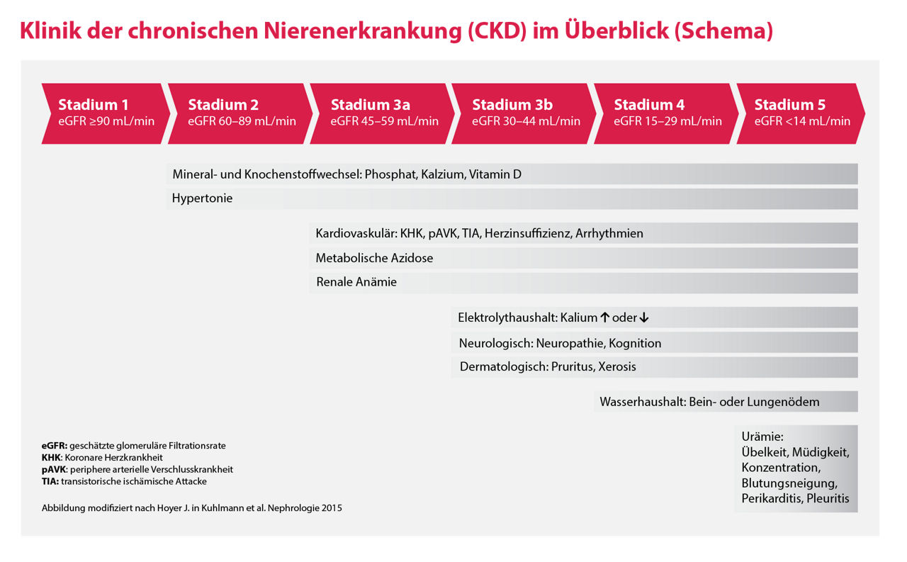 Diagramm mit den Stadien der chronischen Nierenerkrankung (CKD) nach eGFR, mit den zugehörigen Symptomen und Komplikationen, die unter jedem Stadium in deutscher Sprache zusammengefasst sind.