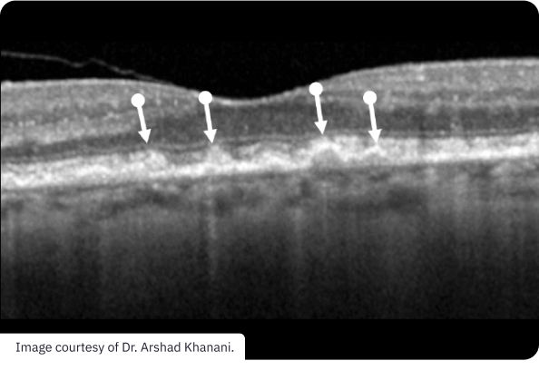  Intermediate Disease-1