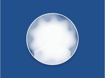 Vision loss5