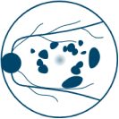 Large Baseline Lesions