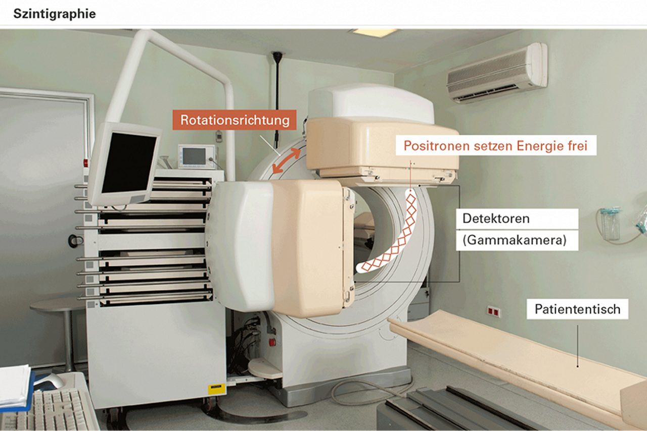 Ausbreitungsdiagnostik