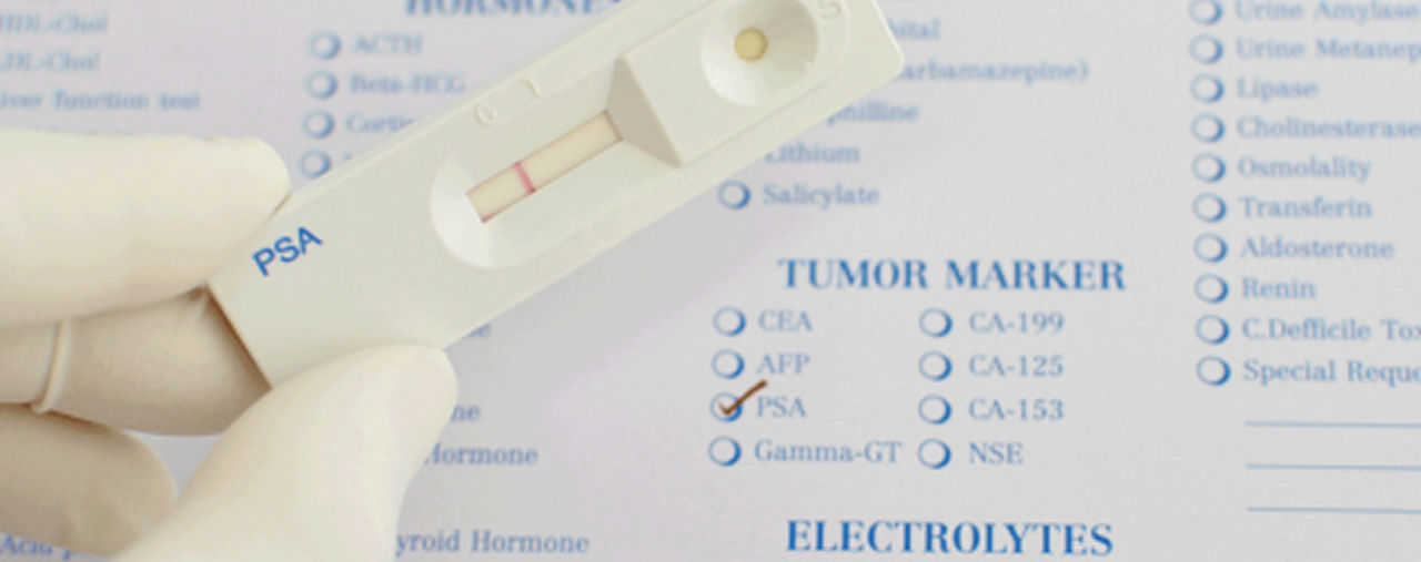 PSA-Test
