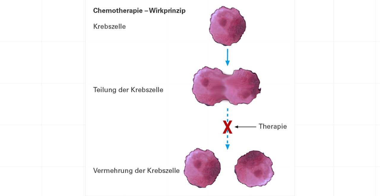 Chemotherapie