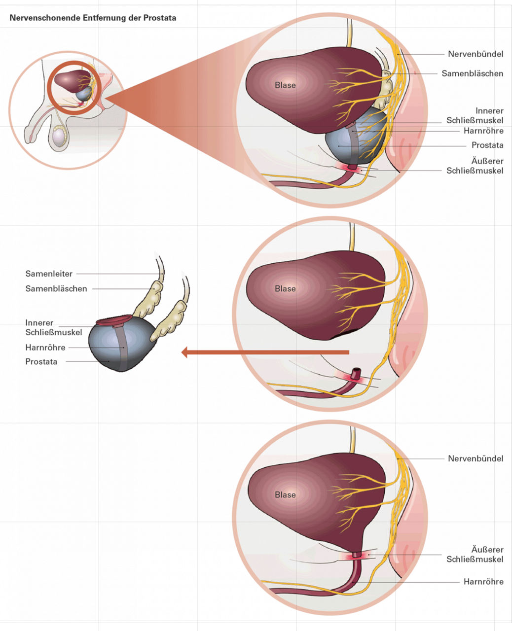 Funktion der Blasenschließmuskeln
