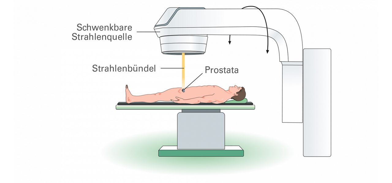 Bestrahlungsmethoden
