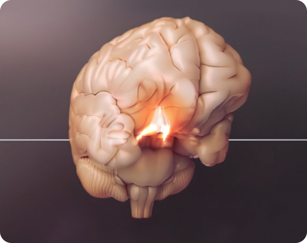 Hersenen waarbij een dwarsdoorsnede van de hypothalamus is gemarkeerd.