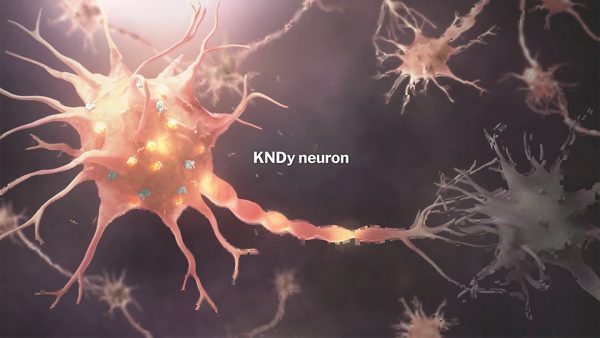 A look at a KNDy neuron
