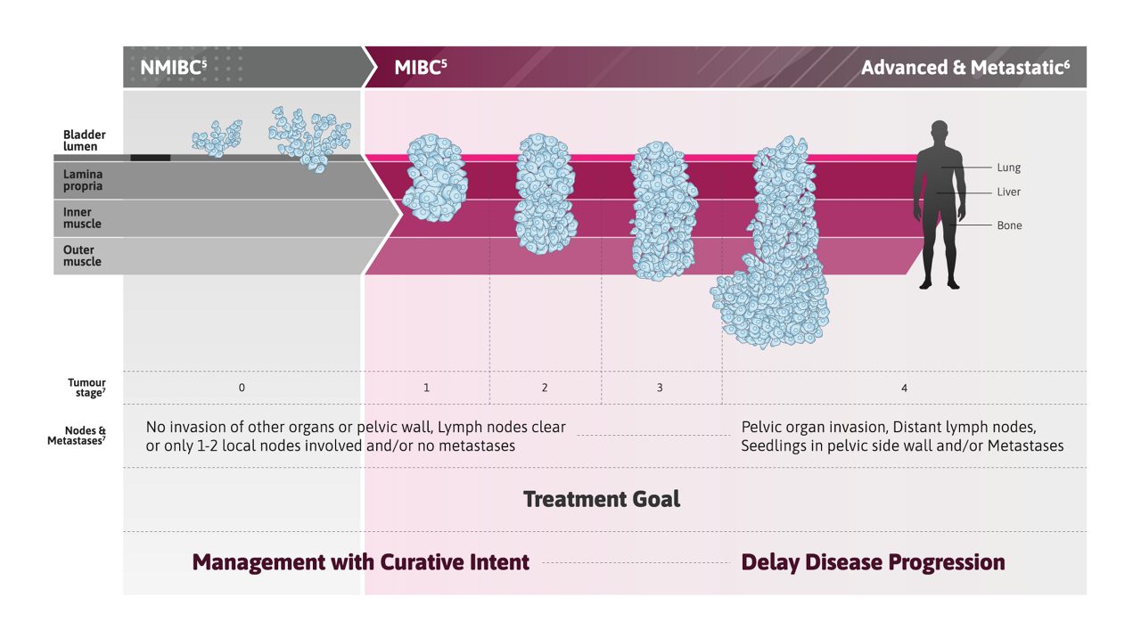 Advanced & Metastatic
