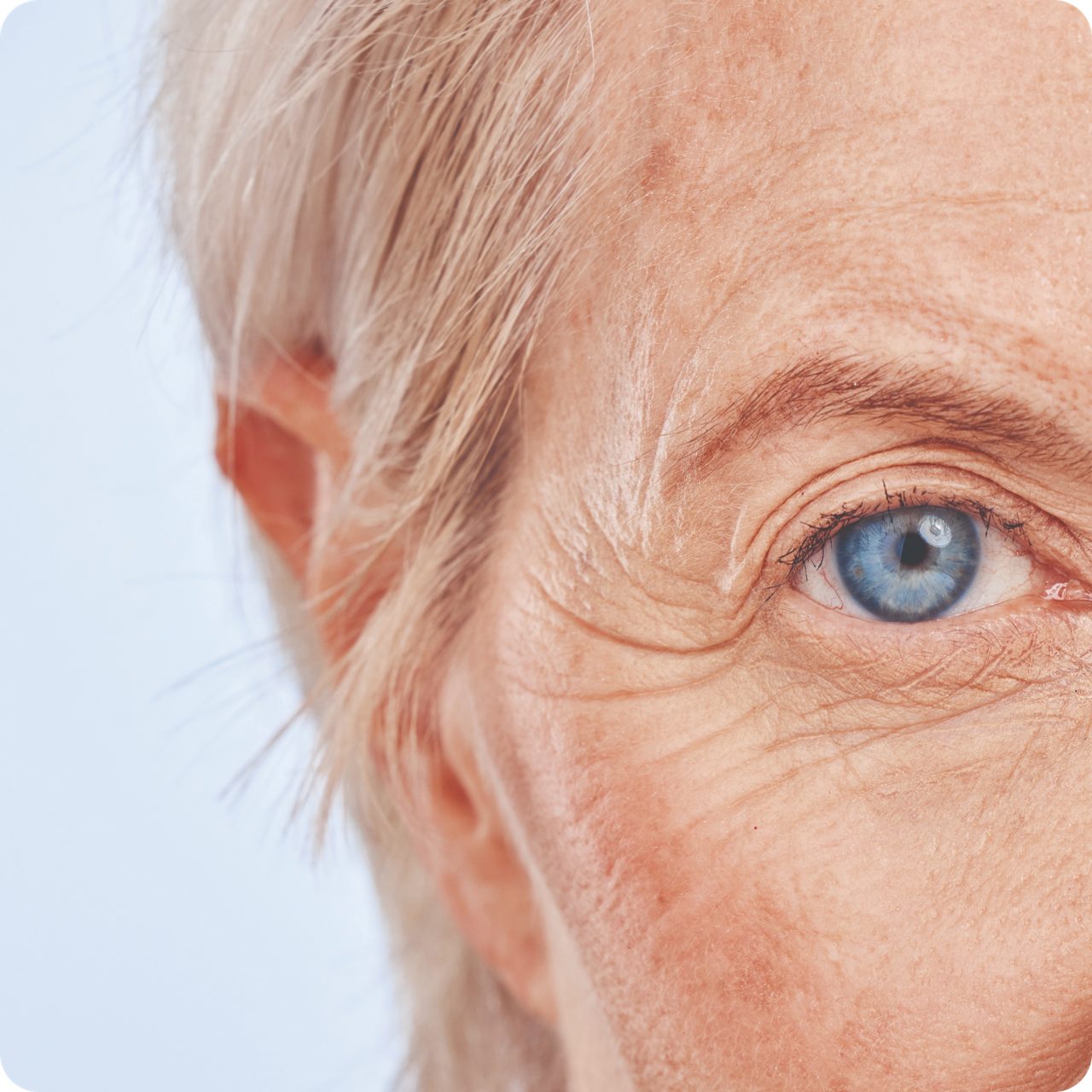Close-up of a patient's blue eye receiving vision care, highlighting Astellas’ dedication in the ophthalmology space.
