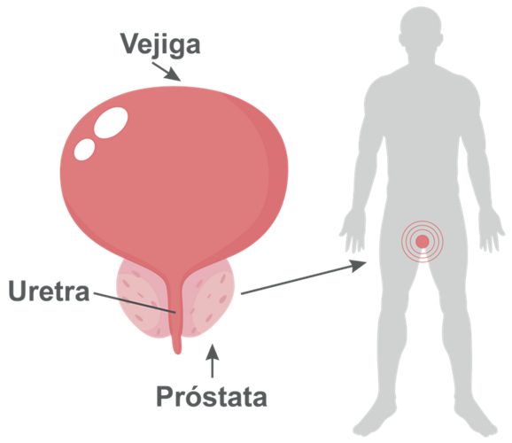 Prostactivos