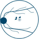 Small Baseline Lesions