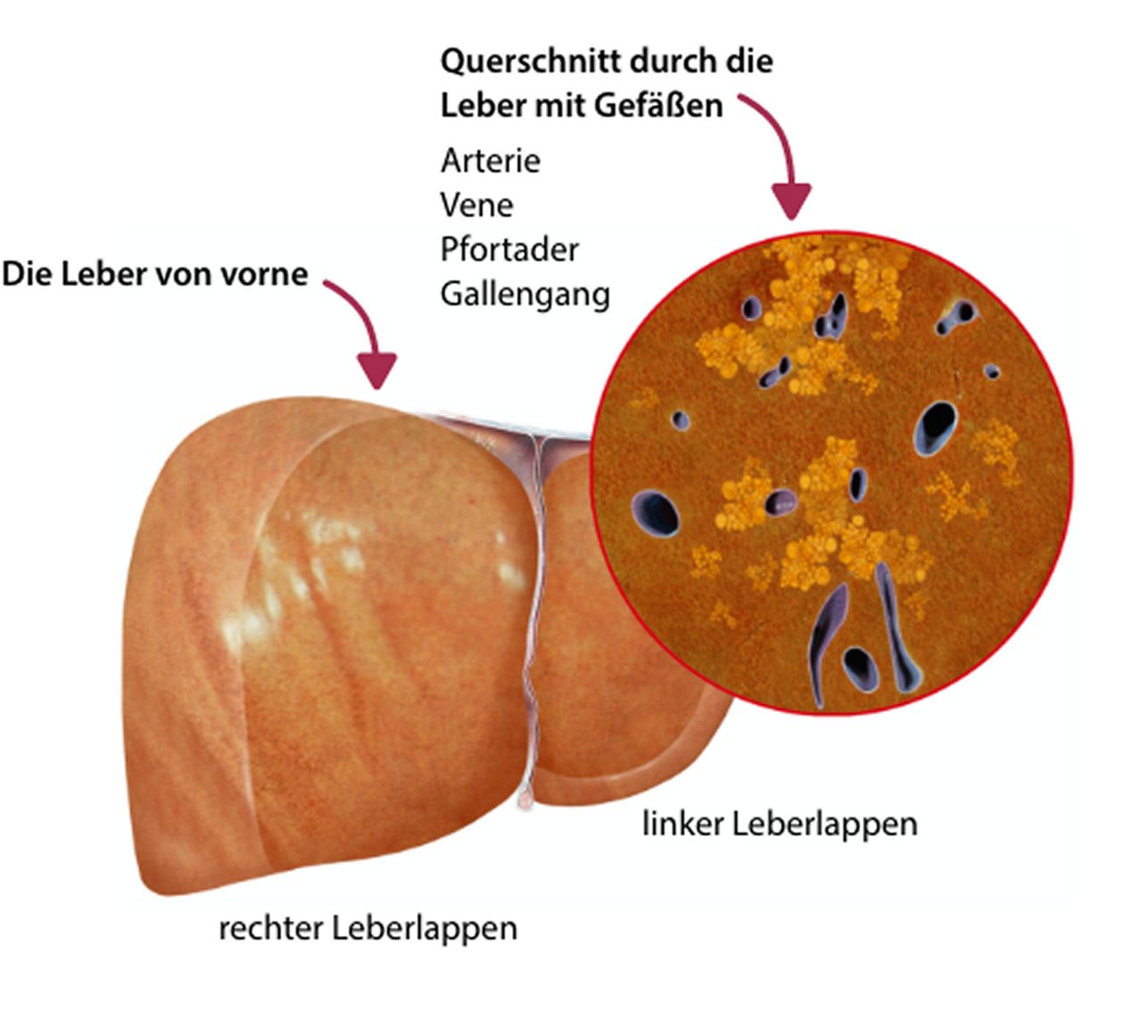 Bei der sogenannten Fettleber ist die Funktion der Leber nachhaltig gestört
