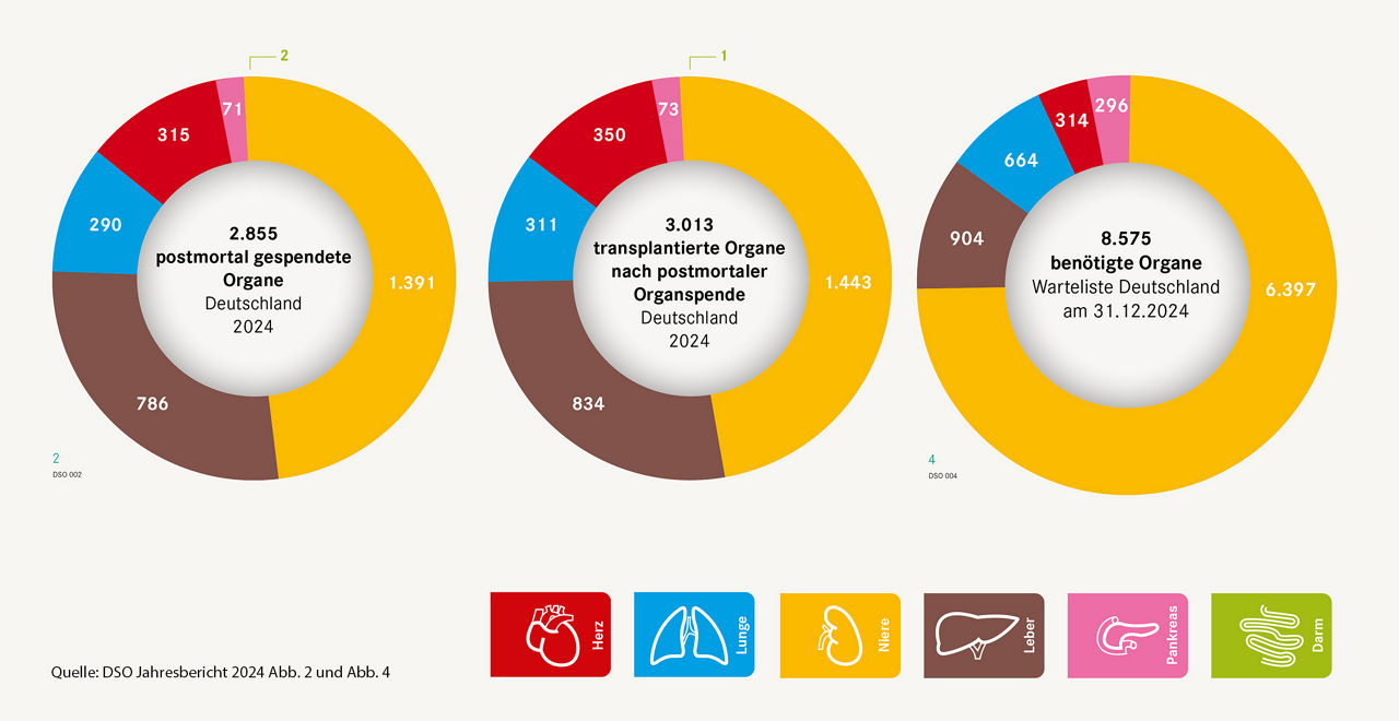 Der Bedarf an Organspenden in Deutschland ist hoch 