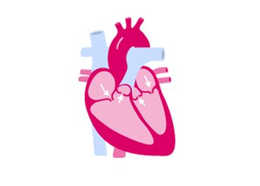 Illustration eines menschlichen Herzens in Rosa- und Rottönen mit den wichtigsten Arterien und Venen vor einem weißen Hintergrund.