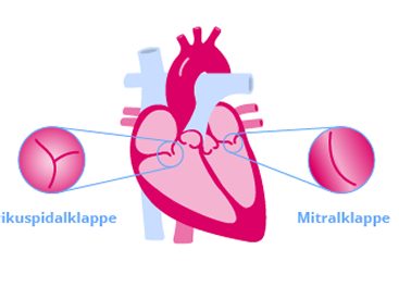Schema eines menschlichen Herzens mit Beschriftungen und Nahaufnahmen der Trikuspidalklappe und der Mitralklappe.