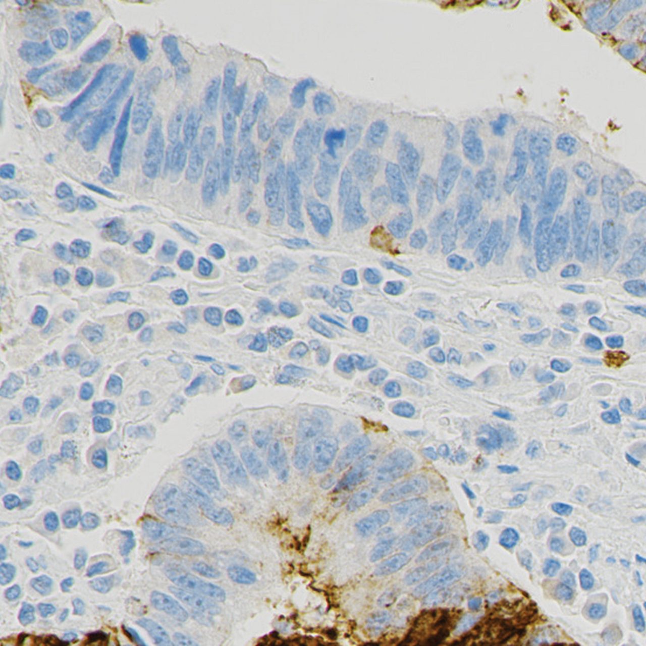 Photo showing an example of no CLDN18 staining