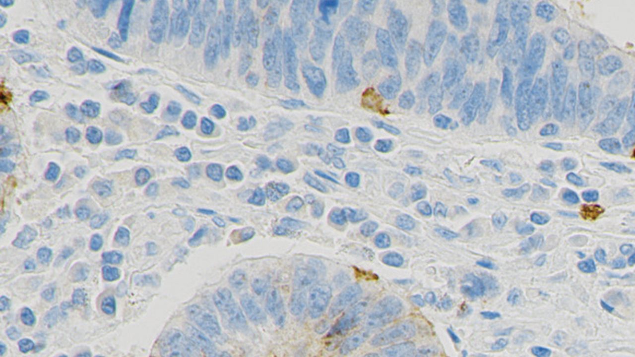 Photo showing an example of no CLDN18 staining