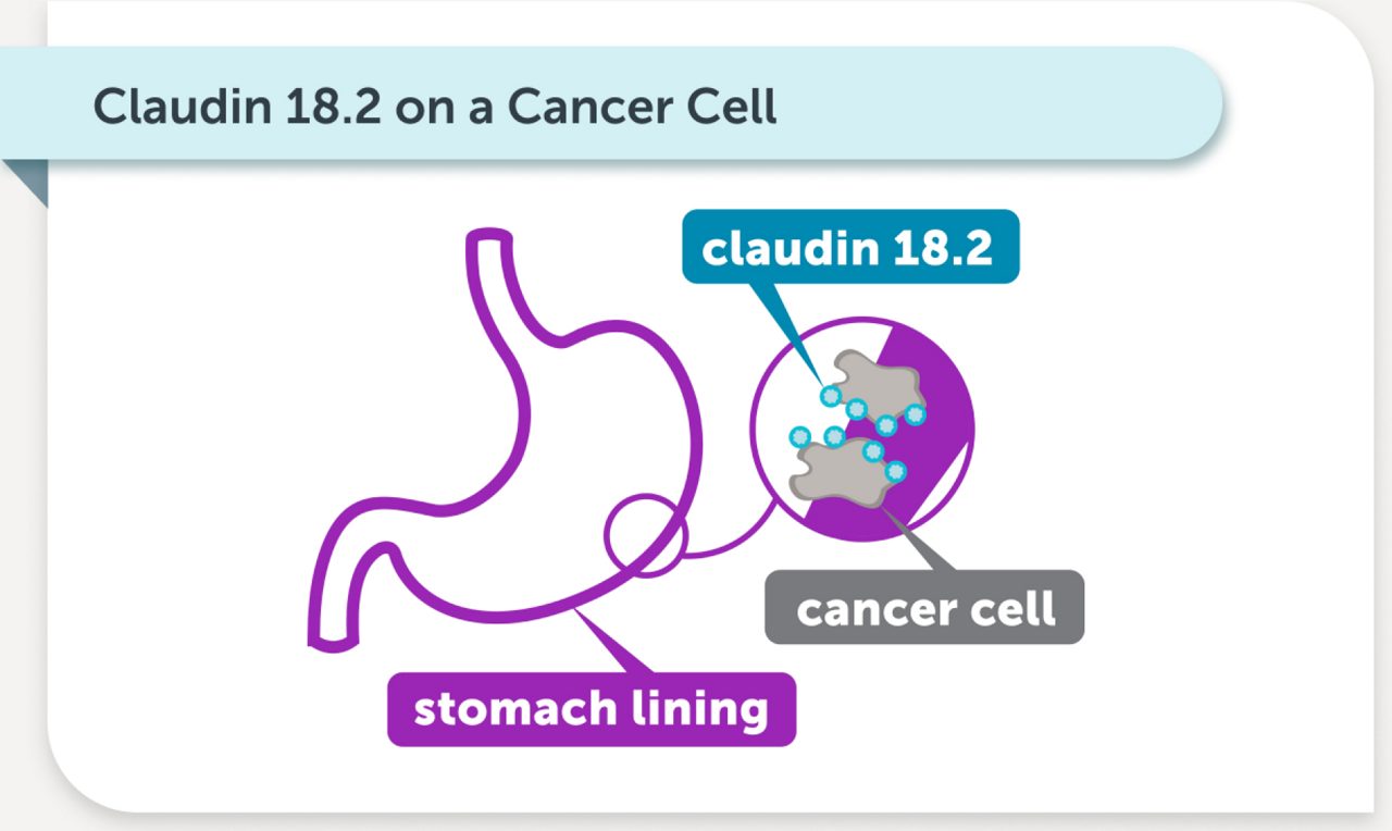 Claudin 18.2 on a Cancer Cell