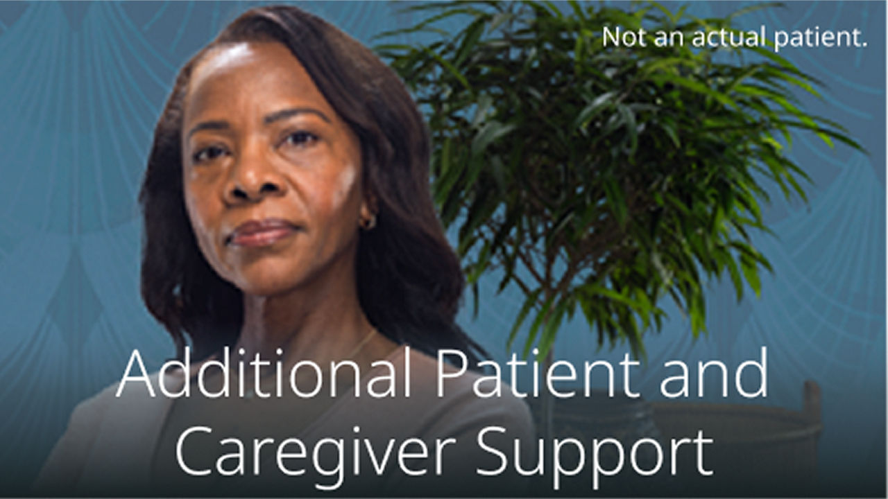 Woman standing in front of a small tree.