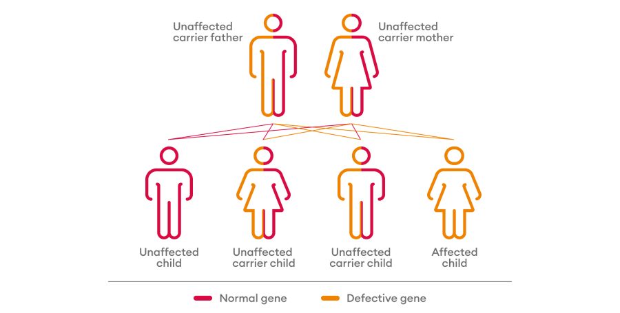 How someone inherits Pompe disease