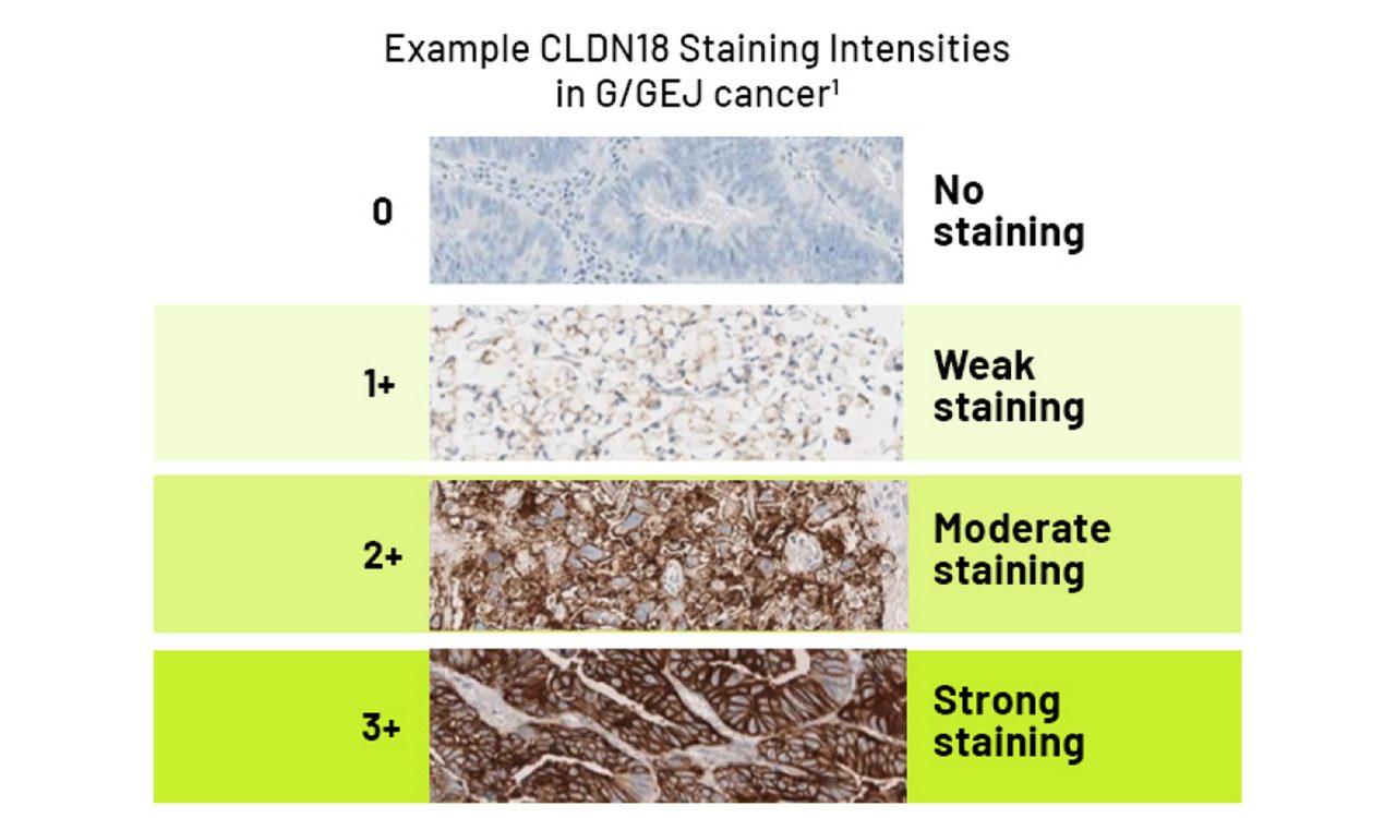 Example-CLDN