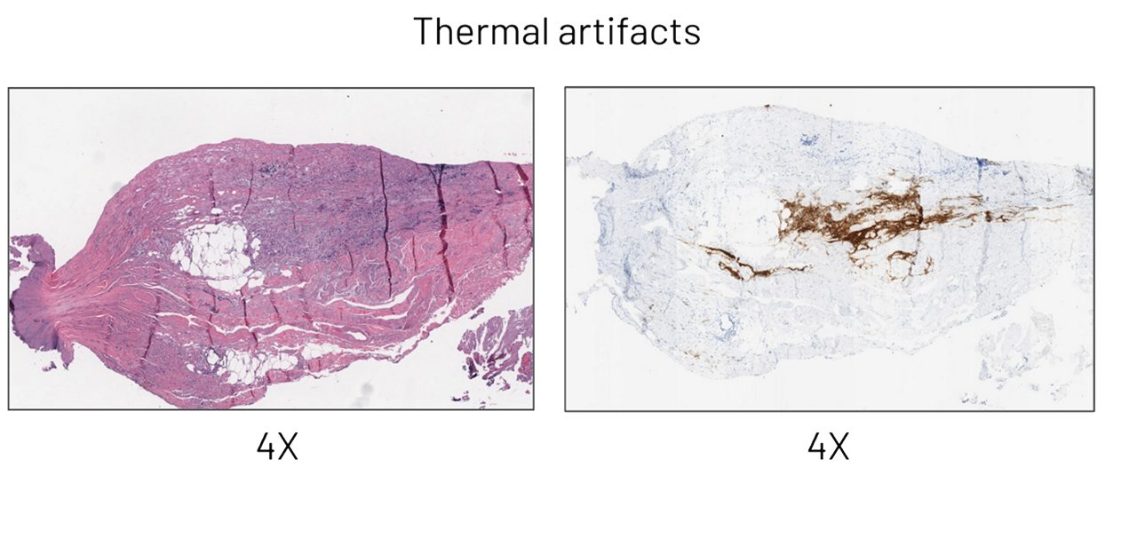 preanalytical-artifacts