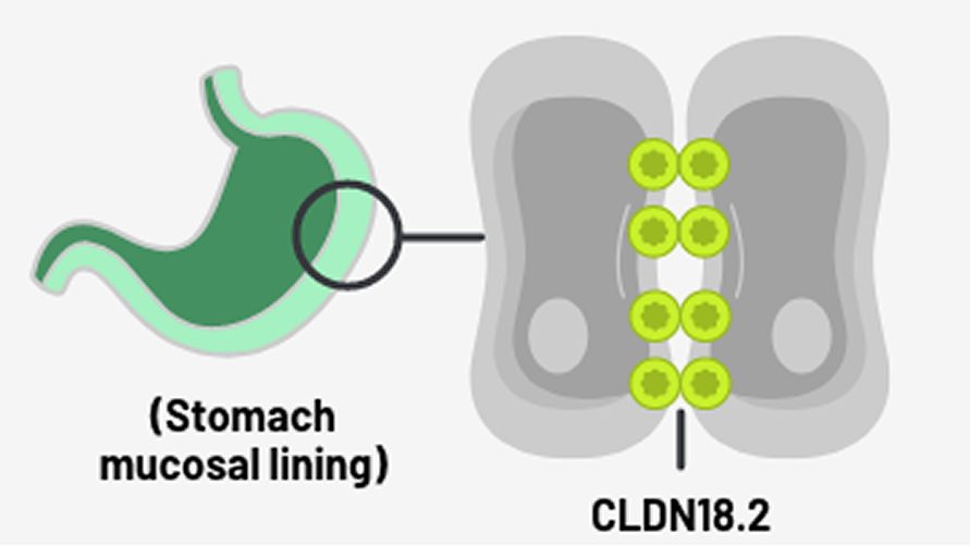 Confined in healthy tissue